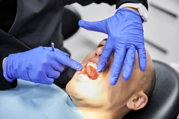 Best Chipped Tooth Repair Near Me  in West Bishop, CA